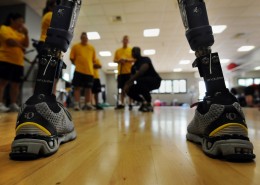 Photo of a wounded soldier's prosthetic legs.