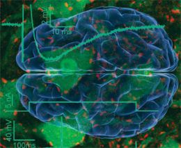 Photo of a brain scan