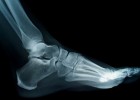 photo of a foot x-ray